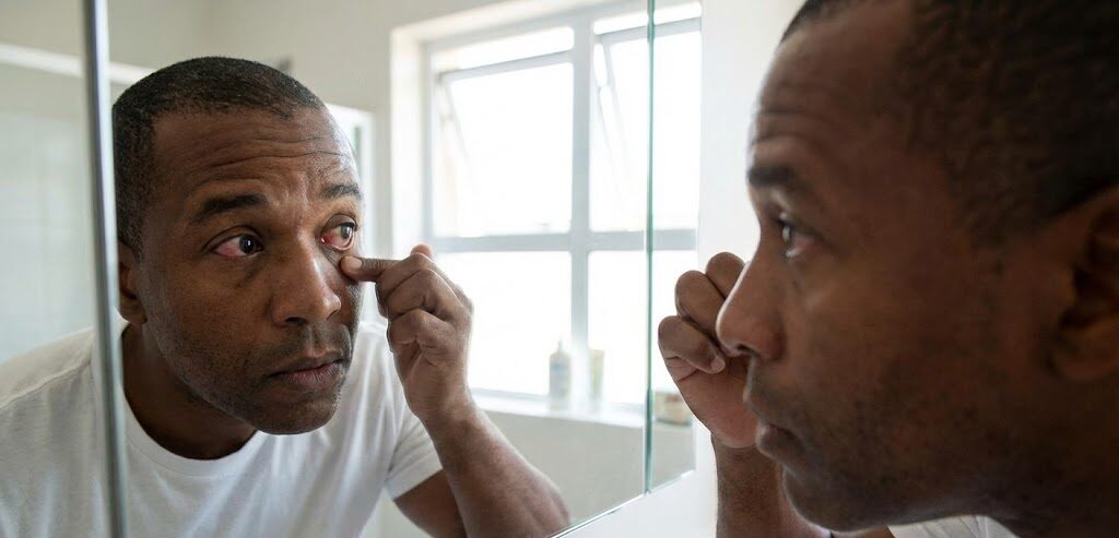 Man realizing his eyes are red